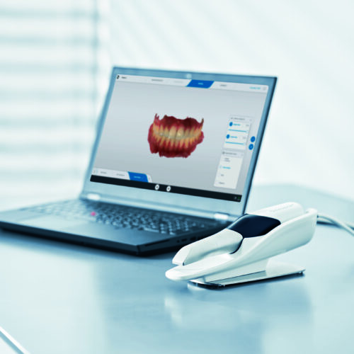 Primescan Connect